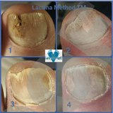 Lacuna Method workshop ONLINE VERSION NOW AT KAJABI.COM