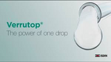 Verrutop Verrucca treatment workshop now at KAJABI.com!